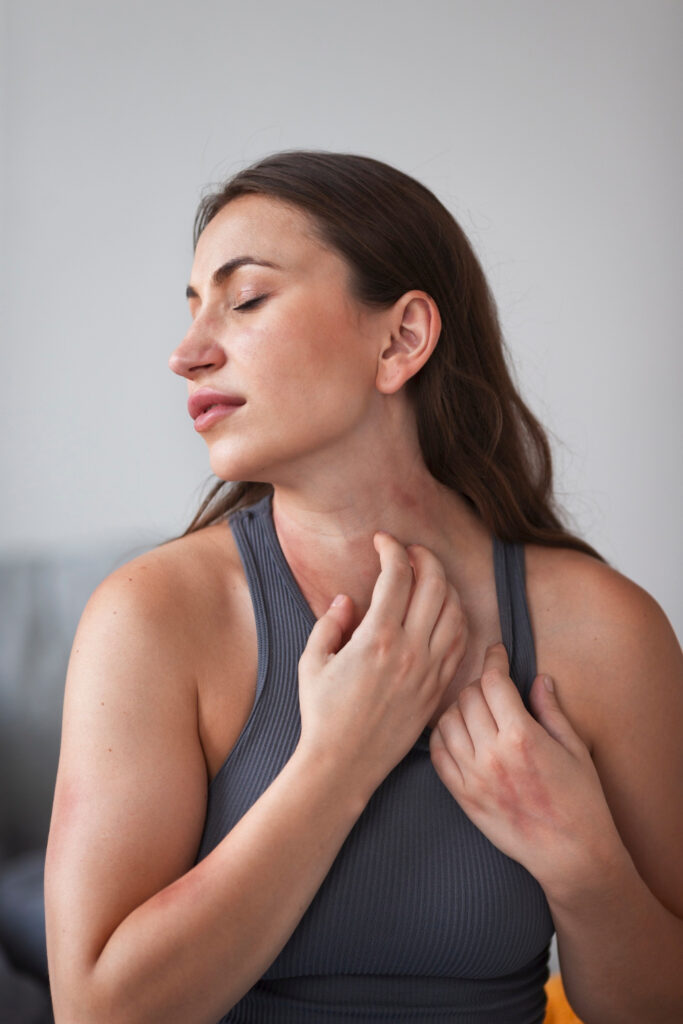 Dermatitis Atópica Síntomas, Causas y Tratamientos Efectivos - Leire Loidi Consulta Dermatología Pamplona