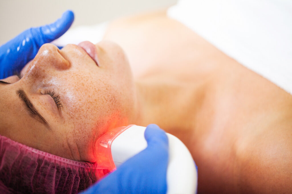 Luz Pulsada Intensa (IPL) Qué es, Beneficios y Tratamientos Efectivos - Docotora Dermatologia Pamploan - Leire Loidi