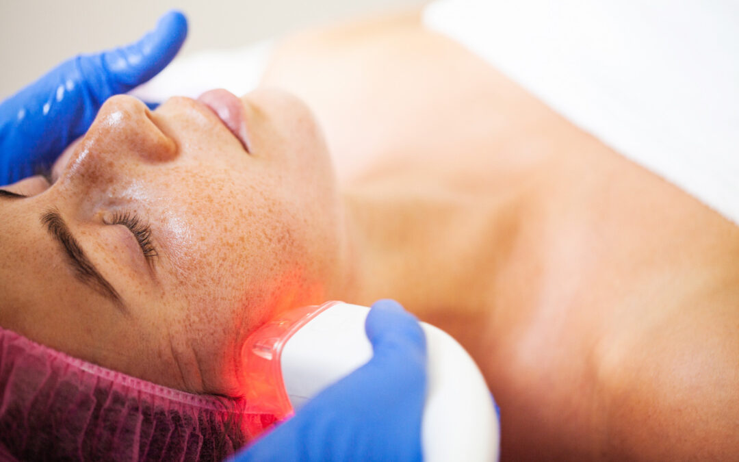 Luz Pulsada Intensa (IPL): Qué es, Beneficios y Tratamientos Efectivos